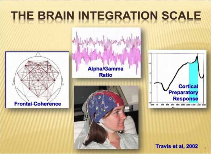 49_Bevan.jpg - The Brain Integration Scale, designed by Dr Fred Travis and others, gives every student the opportunity to see how coherence in their brain is increasing over time. Periodic EEG readings are a key feature in Consciousness-Based Education that Maharishi University of Management offers.